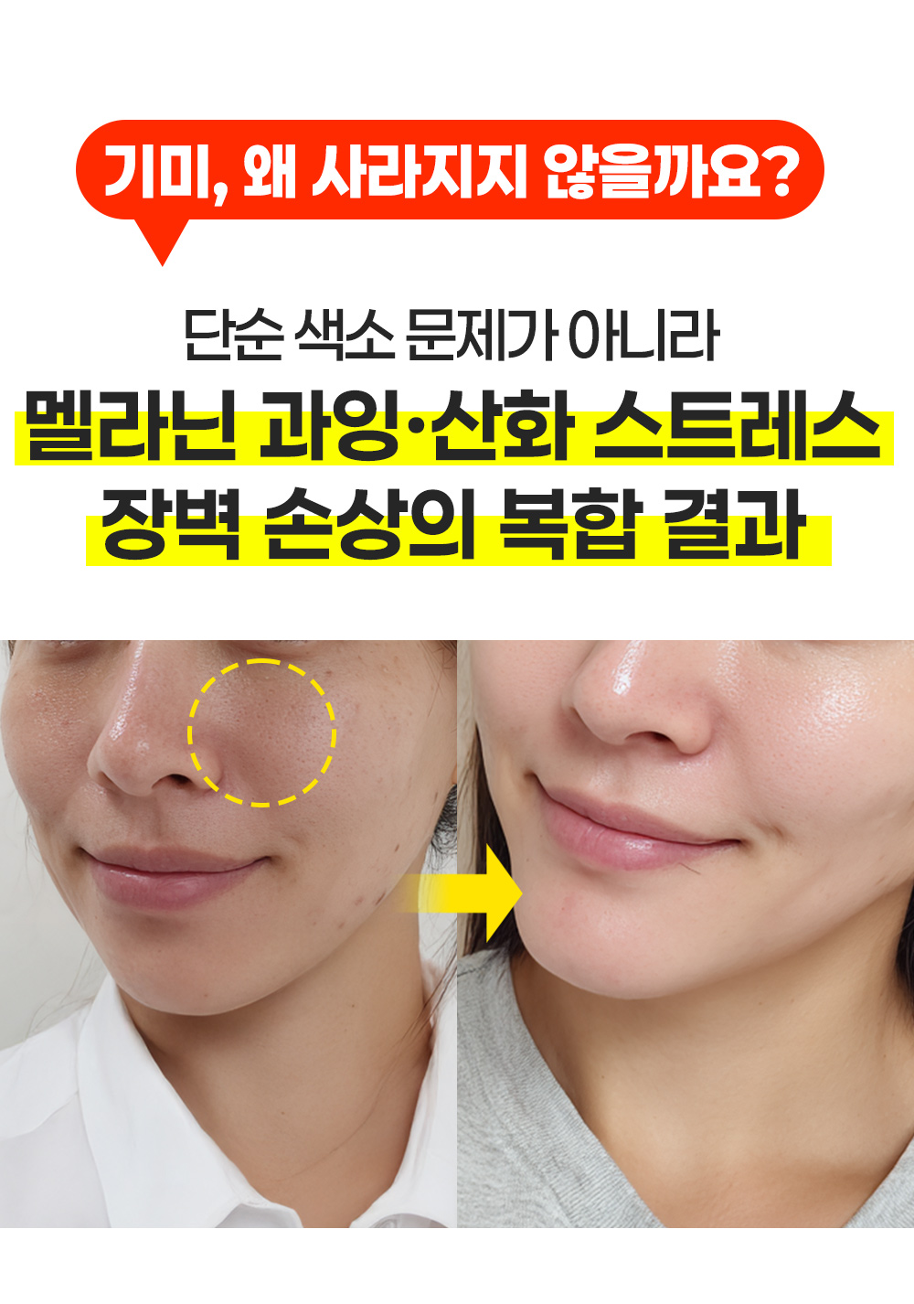 월귤4050_19.jpg