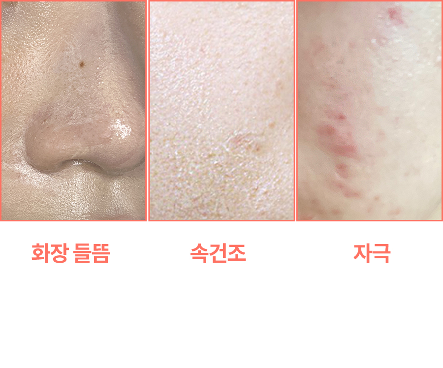 z_peeling_page_11.jpg