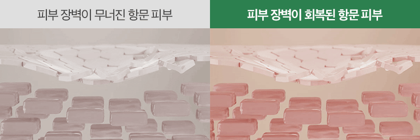 메디율_여성용_27.gif