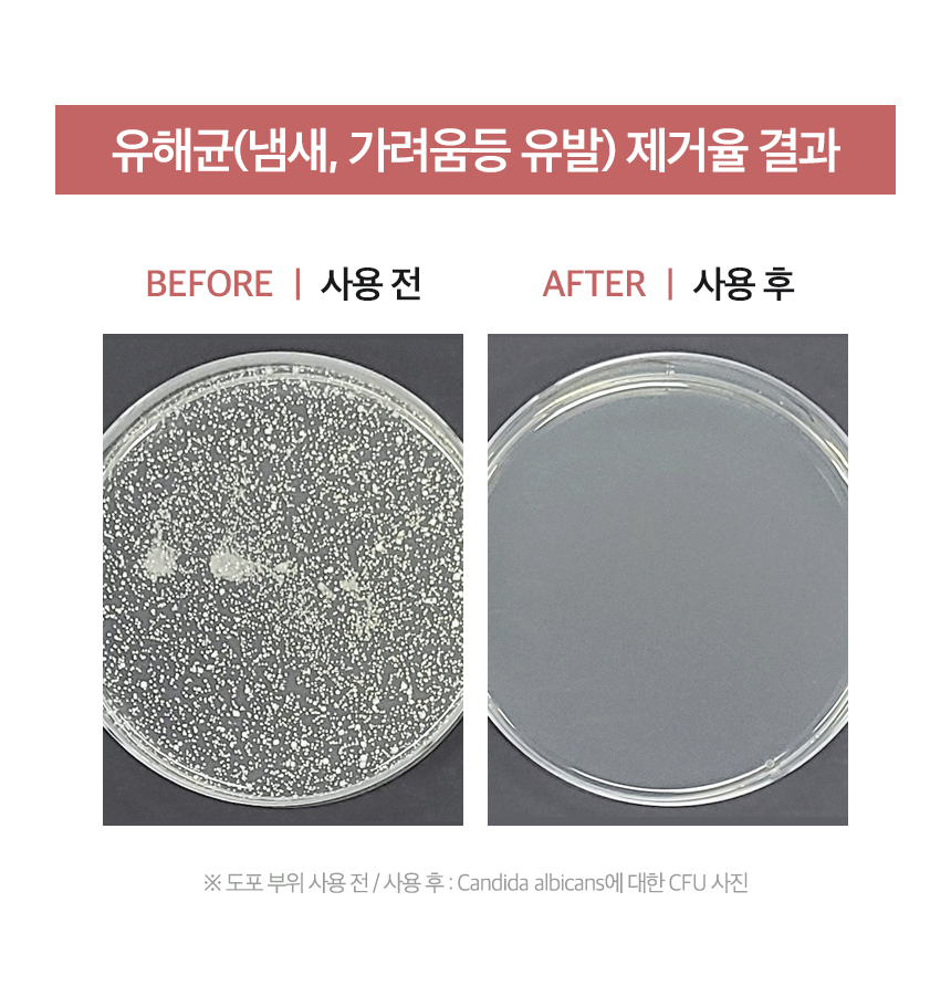 메디율_여성용_011.gif